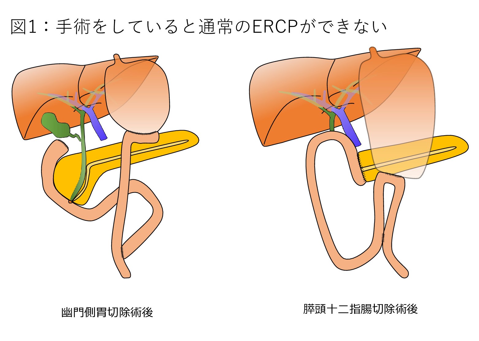 2021年 | 社会医療法人 製鉄記念室蘭病院 2021年 | 社会医療法人 製鉄記念室蘭病院